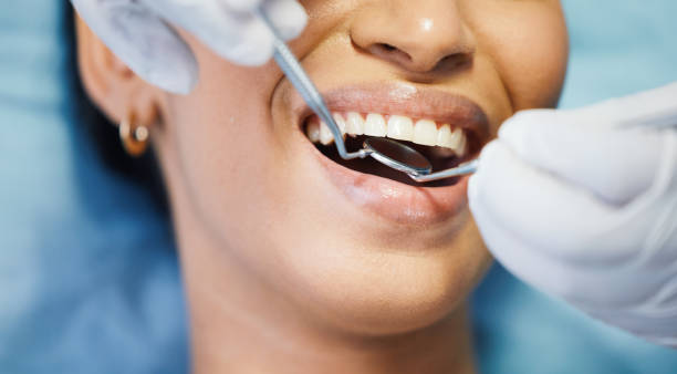 Best Emergency Dental Care for Broken or Chipped Teeth in Cnelius, OR