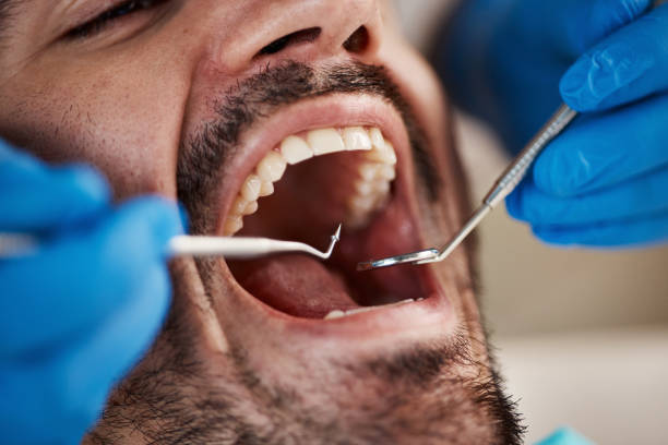 Best Emergency TMJ Treatment in Cnelius, OR