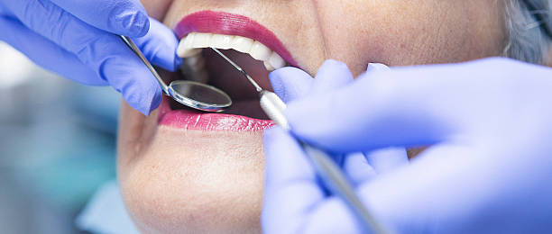 Best Emergency Dental Care for Broken or Chipped Teeth in Cnelius, OR